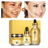 Daralis 3PCS 24K Gold Hyaluronic Acid Face Skin Care Set